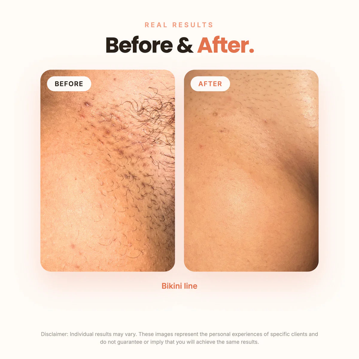 The Brightening Lab ™ BBL SERUM