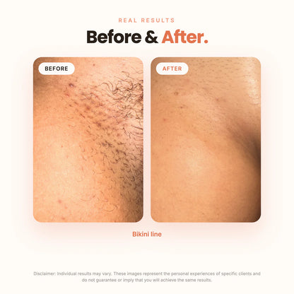 The Brightening Lab ™ BBL SERUM