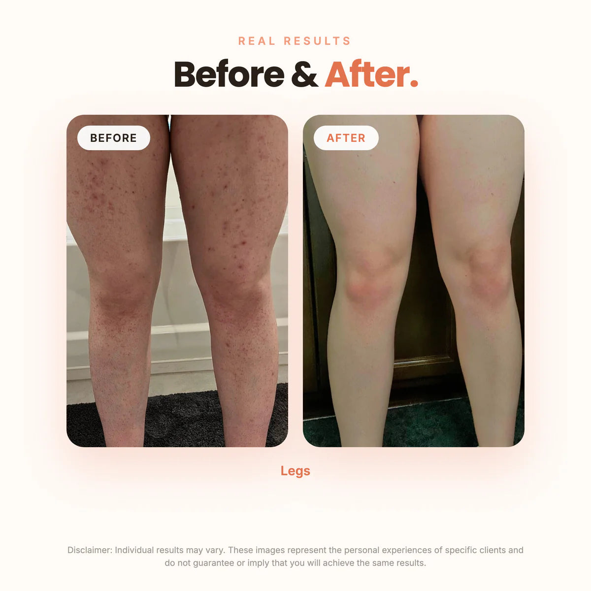 The Brightening Lab ™ BBL SERUM