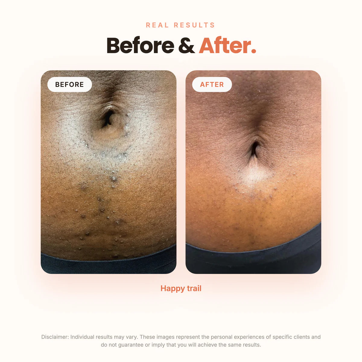 The Brightening Lab ™ BBL SERUM